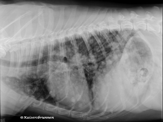 Vitamin K1 und KrebsKrebsentstehung,Krebsverhinderung,Krebszellen